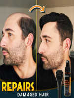 Hair & Beard Growth Essence Spray - Best Price in Bangladesh | Shampoobd