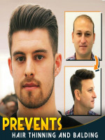 Hair & Beard Growth Essence Spray - Best Price in Bangladesh | Shampoobd