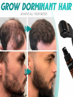 Hair & Beard Growth Essence Spray - Best Price in Bangladesh | Shampoobd