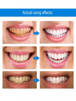 Mintsincerely ™ Teeth Whitening Pens - Best Price in Bangladesh | Shampoobd