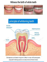 Mintsincerely ™ Teeth Whitening Pens - Best Price in Bangladesh | Shampoobd