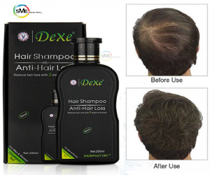 Dexe Anti Hair Loss Shampoo