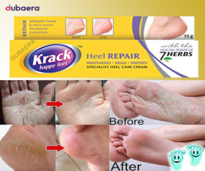 Krack Cream 15 gm