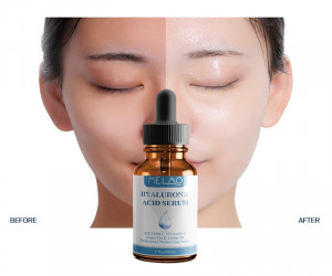 MELAO Face Care Hyaluronic Acid Serum Moisturizing Essence Skin Care Liquid Serum Cosmetics 30ML