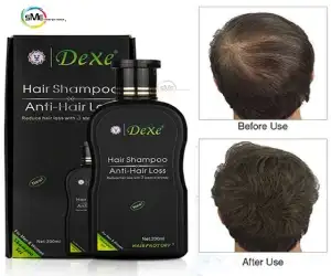 Dexe Anti Hair Loss Shampoo