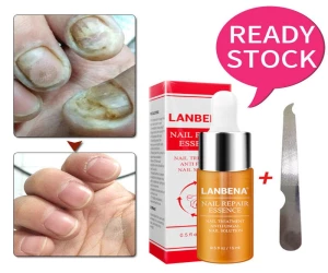 LANBENA Nail Repair Essence Serum